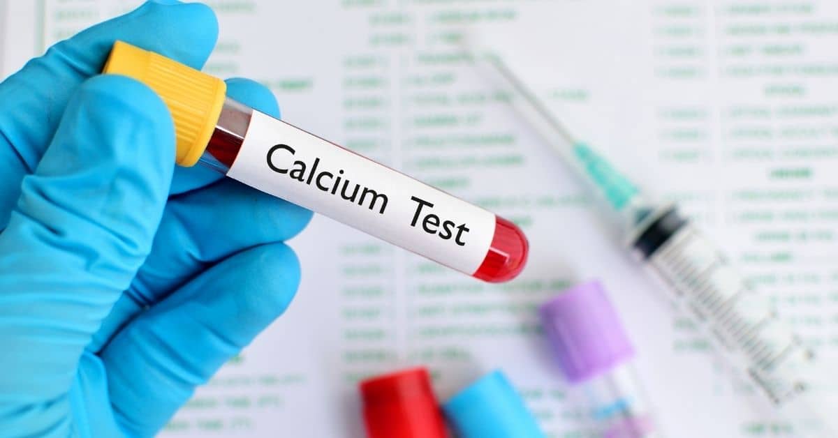 Best Calcium Test Kit